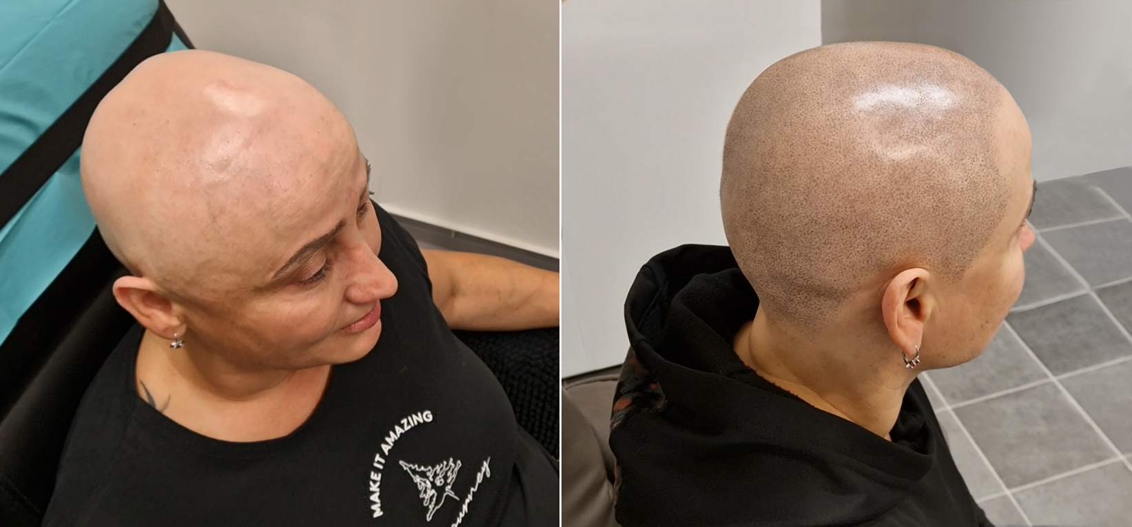 Tetování vlasů mikropigmentace fotografie